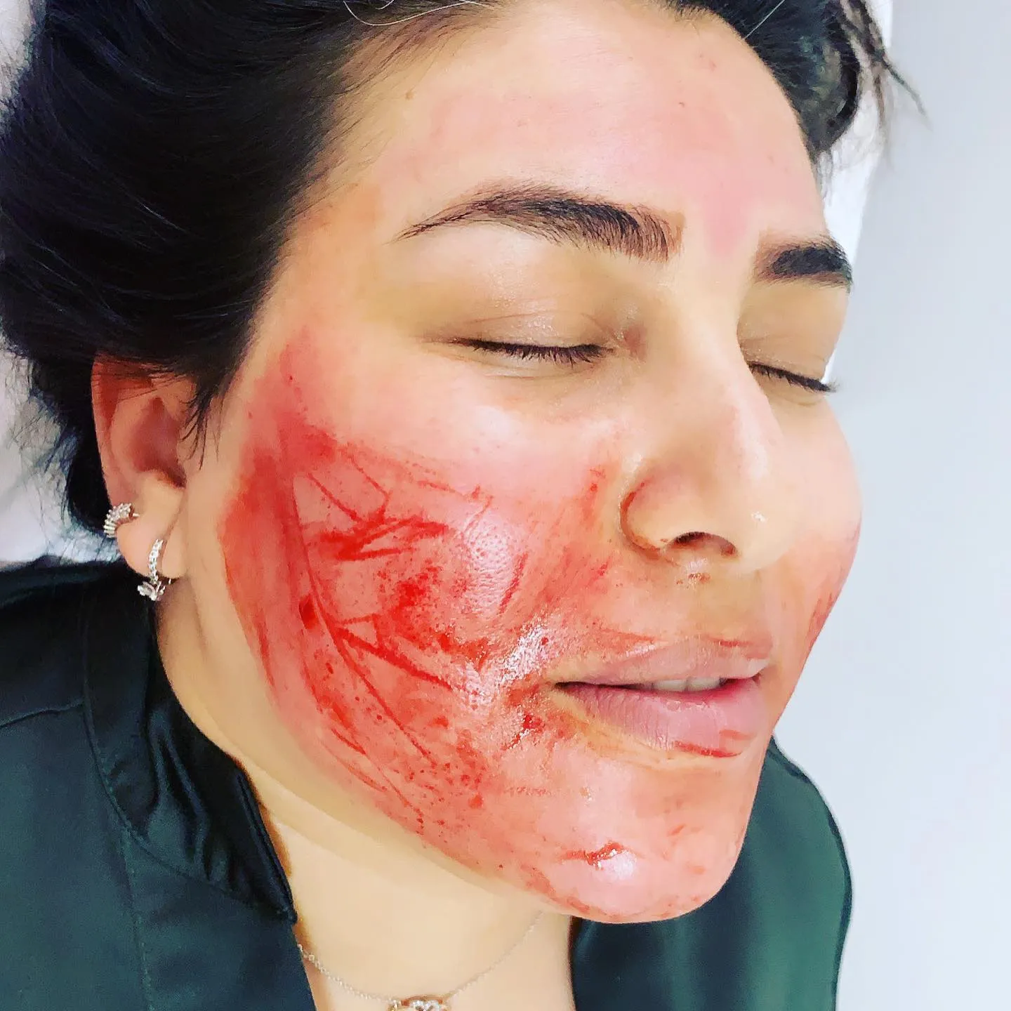 Exempel på Microblading utfört av företaget hos Mn Klinik